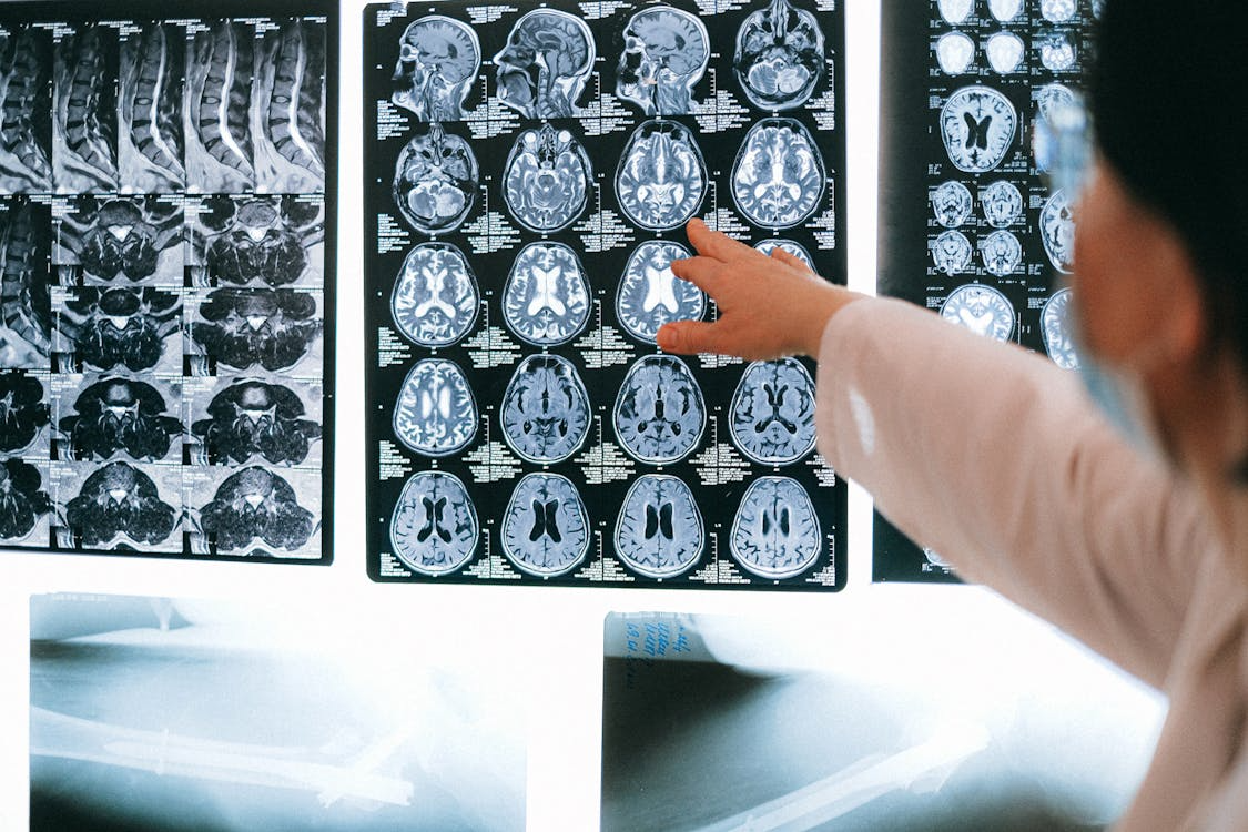 Tomografie computerizată cranio-cerebrală pentru diagnosticul afecțiunilor neurologice