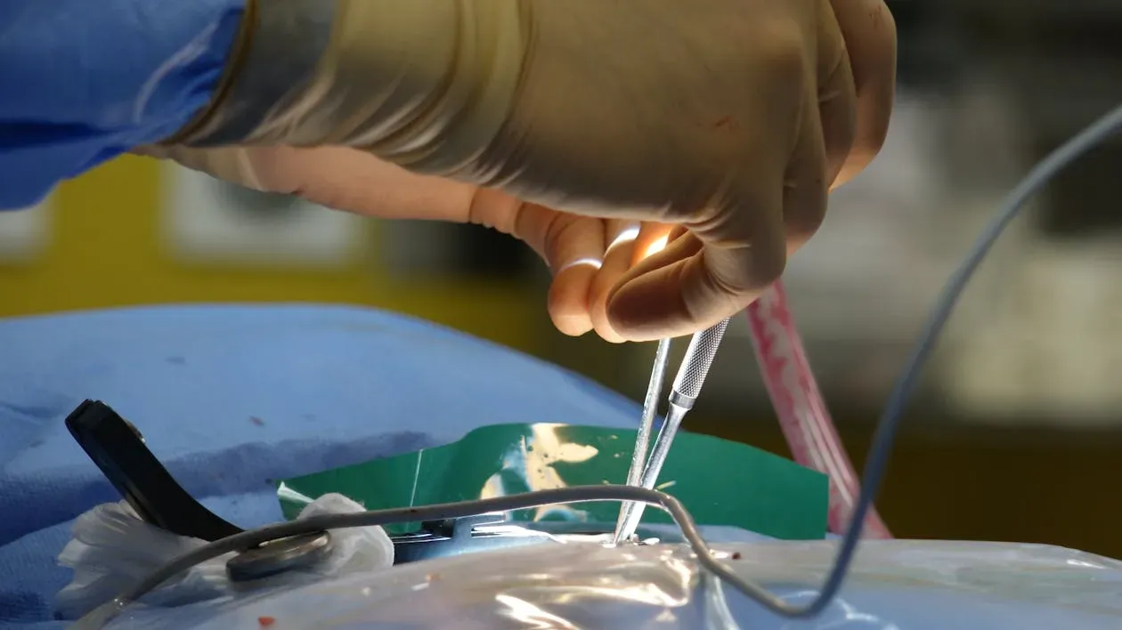 Consult chirurgie vasculară pentru simptome precum dureri de picioare și circulație deficitară